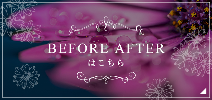 BEFORE AFTER